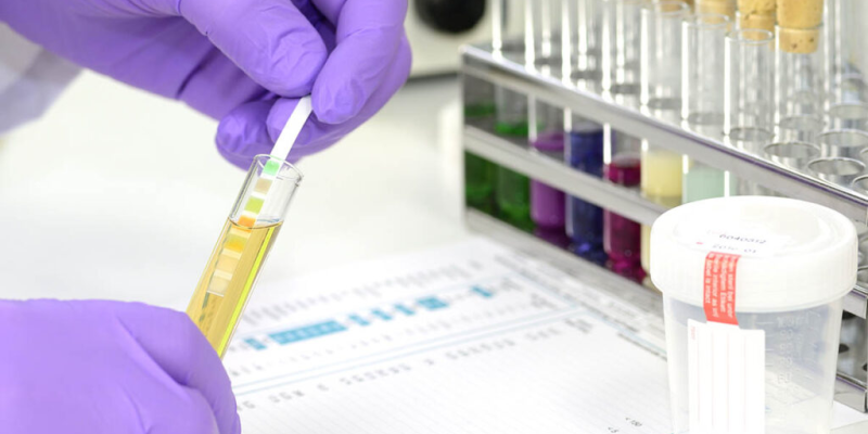 cbdtest